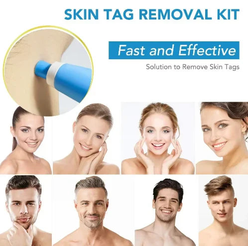 2-In-1 Painless Skin Tag, Mole, And Wart Removal Kit