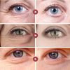 Anti Wrinkle Eye Bag Remover Cream Anti Wrinkle Eye Bag Remover Cream