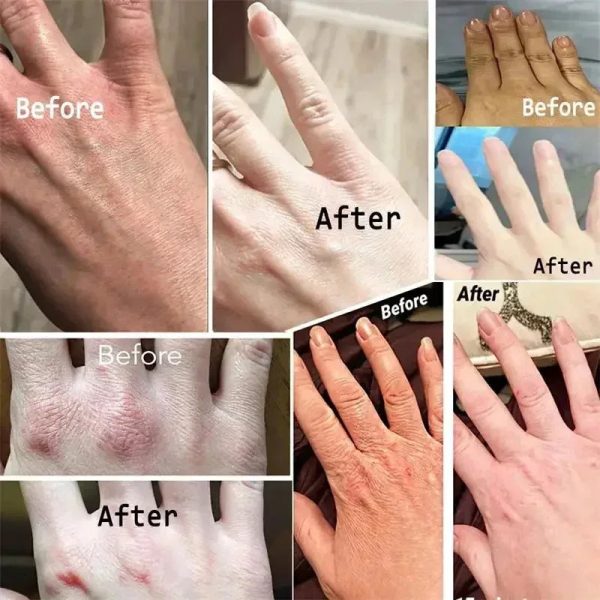 Anti-Wrinkle Hand Cream Anti-Wrinkle Hand Cream