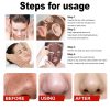 Black Tea Facial Peel Off Mask Black Tea Facial Peel Off Mask