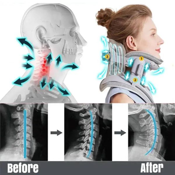 Cervical Traction Neck Brace Neck Traction Device