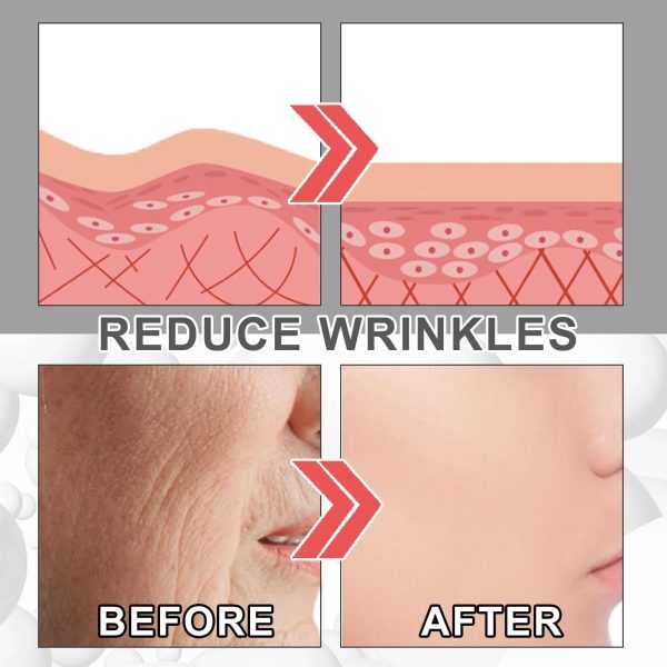 Collagen Anti Wrinkle Cream Collagen Anti Wrinkle Cream