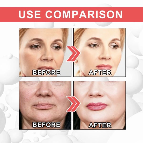 Collagen Anti Wrinkle Cream Collagen Anti Wrinkle Cream