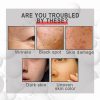 Collagen Anti Wrinkle Cream Collagen Anti Wrinkle Cream