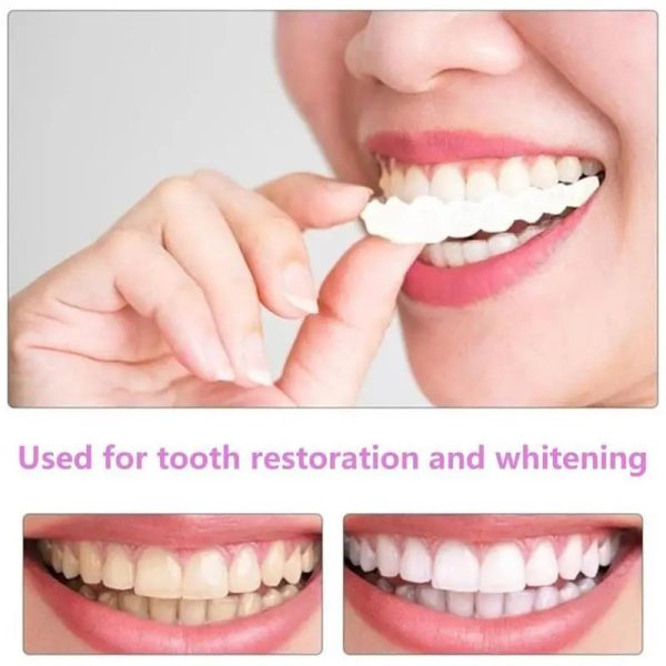 Comfort Fit Temporary Teeth Cover Comfort Fit Temporary Teeth Cover
