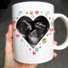 Dear Mommy, This Mother's Day I'll Be Snuggled Up In Your Tummy, Ultrasound Image And Hearts - Personalized Custom Coffee Mug - MOM064_MG Dear Mommy, This Mother's Day I'll Be Snuggled Up In Your Tummy, Ultrasound Image And Hearts - Personalized Custom Coffee Mug - MOM064_MG