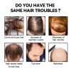 Eelhoe Ball Bearing Dense Hair Essential Oil For Scalp Care Eelhoe Ball Bearing Dense Hair Essential Oil For Scalp Care