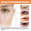 Eelhoe Vitamin C Eye Cream Stick Moisturizing & Brightening For Dark Circles, Puffiness, & Fine Lines Eelhoe Vitamin C Eye Cream Stick Moisturizing & Brightening For Dark Circles, Puffiness, & Fine Lines