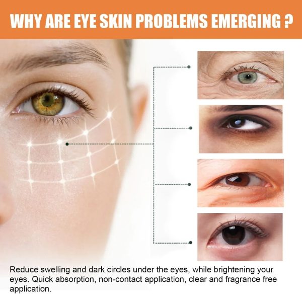 Eelhoe Vitamin C Eye Cream Stick Moisturizing & Brightening For Dark Circles, Puffiness, & Fine Lines Eelhoe Vitamin C Eye Cream Stick Moisturizing & Brightening For Dark Circles, Puffiness, & Fine Lines