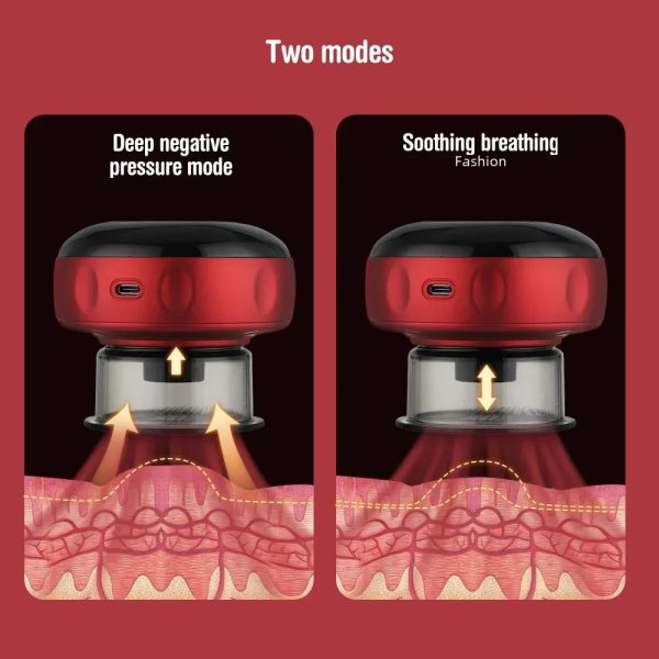 Electric Cupping Massager Tool, Infrared Heated With 12 Levels Suction, Usb Rechargeable