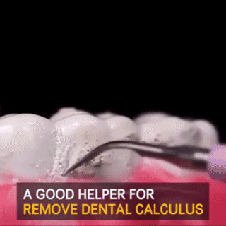 Electric Dental Calculus Remover Electric Dental Calculus Remover