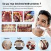 Electric Dental Calculus Remover Electric Dental Calculus Remover