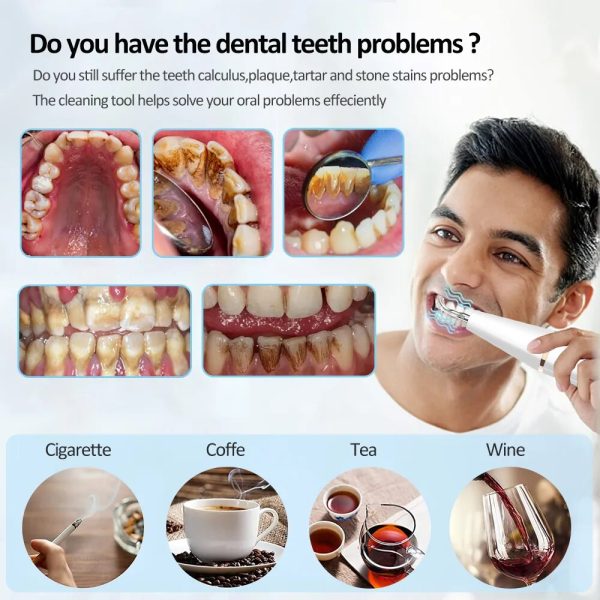 Electric Dental Calculus Remover Electric Dental Calculus Remover