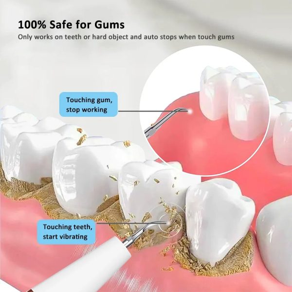 Electric Dental Calculus Remover Electric Dental Calculus Remover