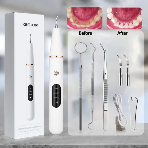 Electric Dental Calculus Remover Electric Dental Calculus Remover