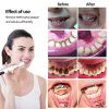 Electric Dental Calculus Remover Electric Dental Calculus Remover