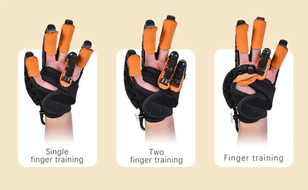 Flexirecover: Transformative Stroke Rehab Glove Flexirecover: Transformative Stroke Rehab Glove