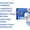 Fungus Laser Therapy Device Fungus Laser Therapy Device