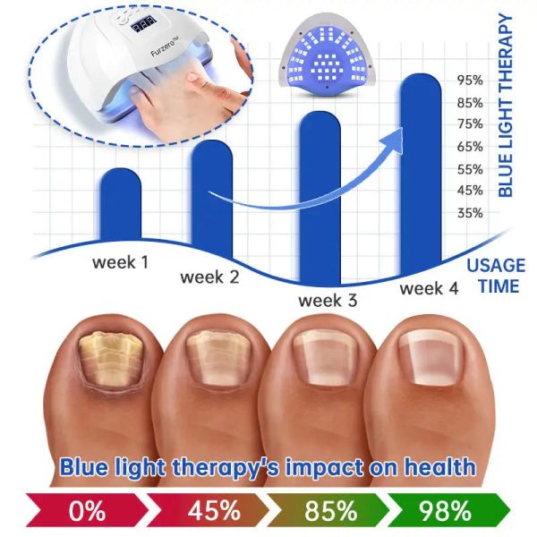 Fungus Laser Therapy Device Fungus Laser Therapy Device