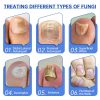 Fungus Laser Therapy Device Fungus Laser Therapy Device