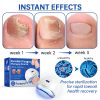 Fungus Laser Therapy Device Fungus Laser Therapy Device