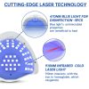 Fungus Laser Therapy Device Fungus Laser Therapy Device
