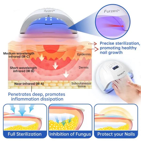 Fungus Laser Therapy Device Fungus Laser Therapy Device