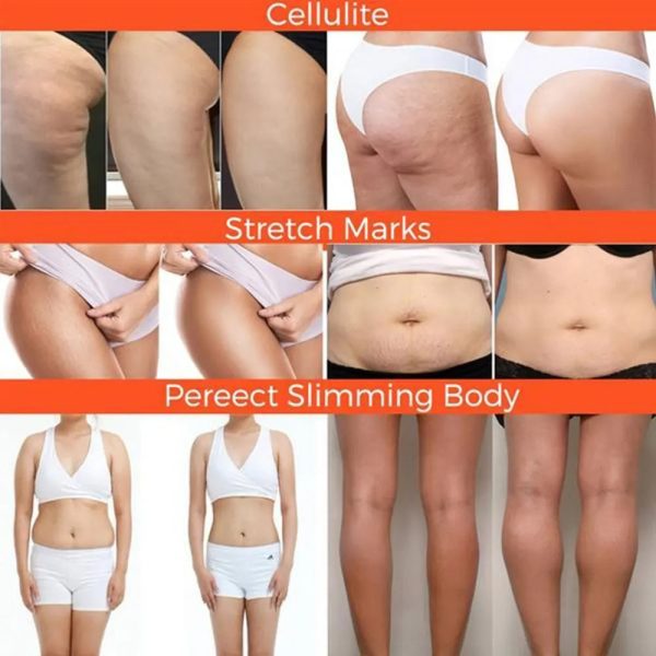 Ginger Fat Burning Cream Ginger Fat Burning Cream