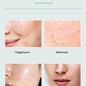 Green Tea Blackhead Remover Mask Green Tea Blackhead Remover Mask