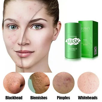 Green Tea Blackhead Remover Mask Green Tea Blackhead Remover Mask