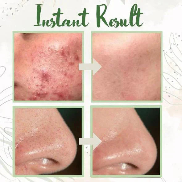 Green Tea Deep Cleanse Mask Green Tea Deep Cleanse Mask