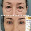 Instant Eye Bag Removal Instant Eye Bag Removal