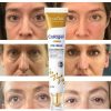 Instant Eye Bag Removal Instant Eye Bag Removal