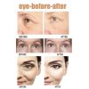 Instant Eye Bag Removal Instant Eye Bag Removal