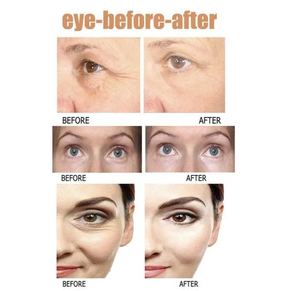 Instant Eye Bag Removal Instant Eye Bag Removal