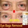Instant Eye Bag Removal Instant Eye Bag Removal