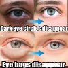 Instant Eye Bag Removal Instant Eye Bag Removal