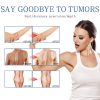 Lipoma Removal Spray Lipoma Removal Spray
