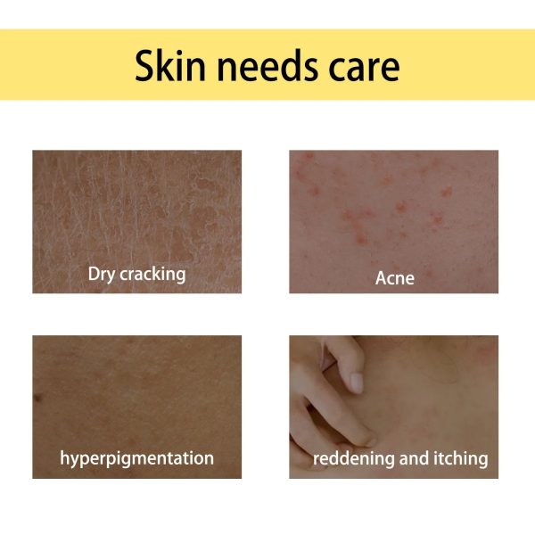 Mango Body Oil Moisturizing & Nourishing Massage Oil For Soft Skin, 100Ml Mango Body Oil Moisturizing & Nourishing Massage Oil For Soft Skin, 100Ml