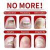 Nail Fungus Defender Serum Nail Fungus Defender Serum