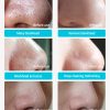 Nose Pore Strip Blackhead Remover
