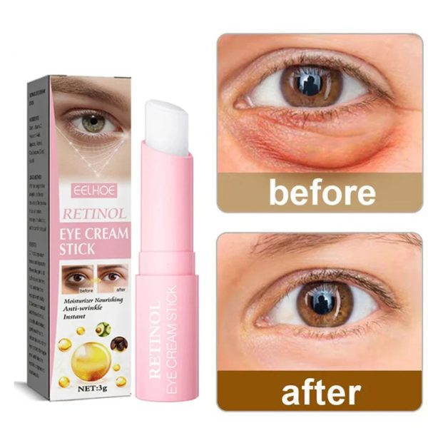 Retinol Eye Cream Instant Removing Eyes Wrinkle Retinol Eye Cream Instant Removing Eyes Wrinkle