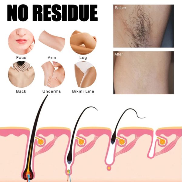 Semi-Permanent Hair Removal Spray Semi-Permanent Hair Removal Spray