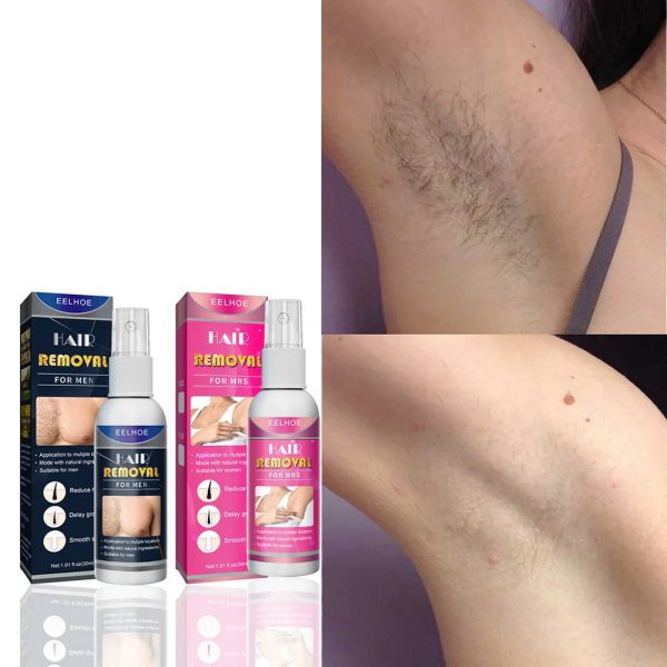 Semi-Permanent Hair Removal Spray Semi-Permanent Hair Removal Spray