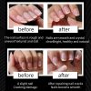 Smart Nail Clipper Polisher Electric Nail Trimmer Smart Nail Clipper Polisher Electric Nail Trimmer