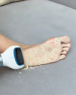 Usb Foot Callus Remover Pedicure Tool Usb Foot Callus Remover Pedicure Tool