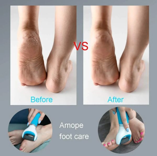 Usb Foot Callus Remover Pedicure Tool Usb Foot Callus Remover Pedicure Tool