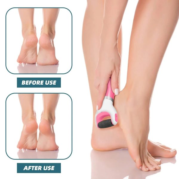 Usb Foot Callus Remover Pedicure Tool Usb Foot Callus Remover Pedicure Tool
