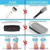 Usb Foot Callus Remover Pedicure Tool Usb Foot Callus Remover Pedicure Tool