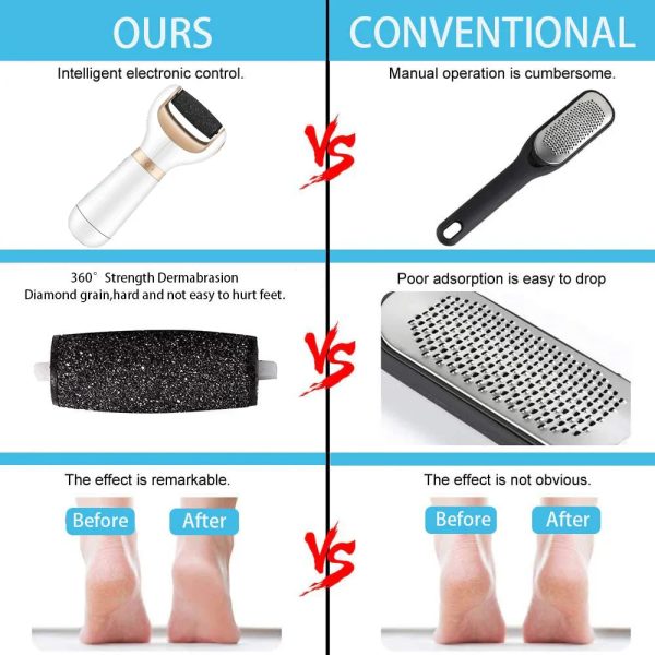 Usb Foot Callus Remover Pedicure Tool Usb Foot Callus Remover Pedicure Tool